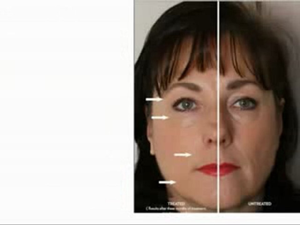 Was währe wenn...___ageLOC Opportunity German