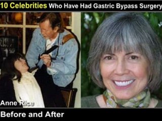 Gastric Bypass