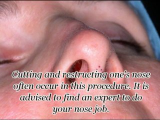 Things You Should Know About Common Cosmetic Surgery Procedu