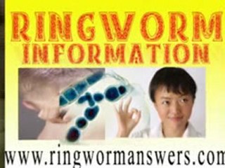 ringworm information