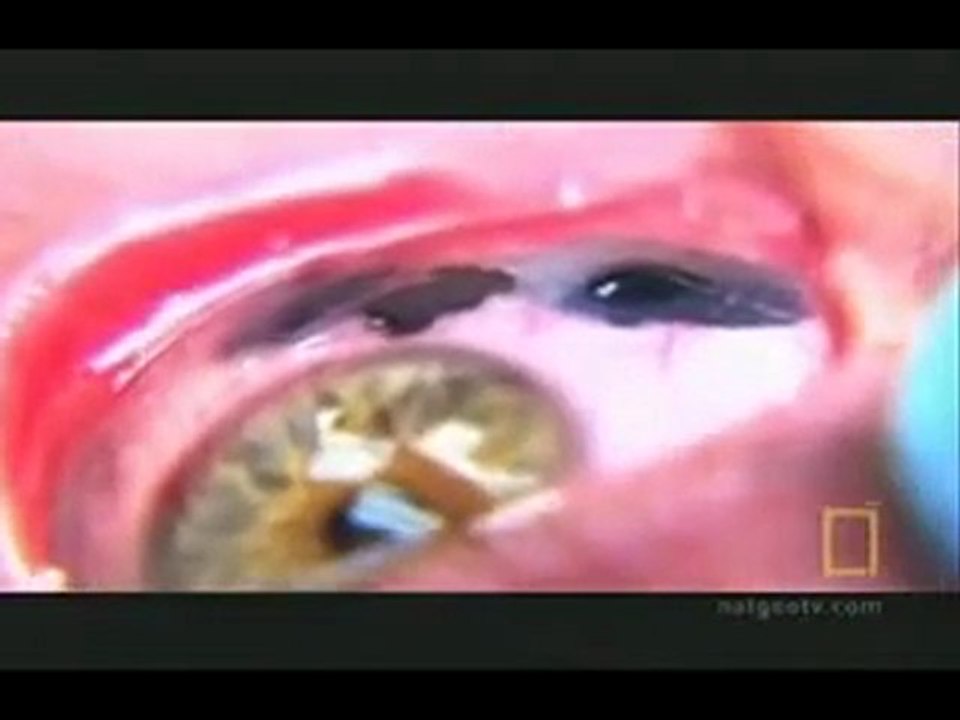 Du jamais vu : Le tatouage des yeux !!!