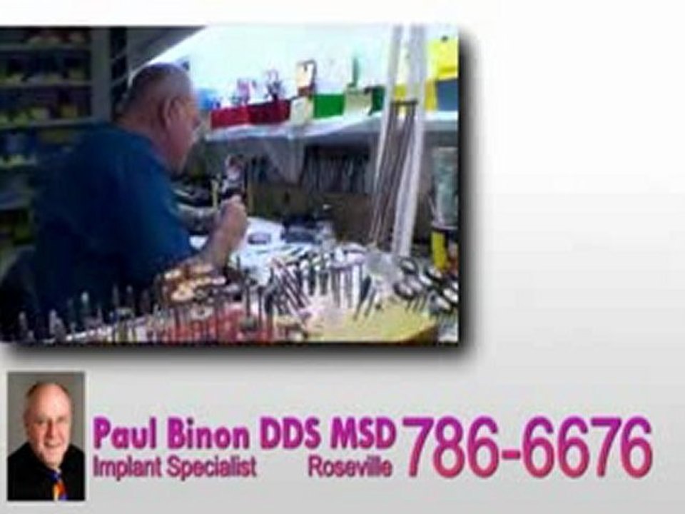 Top Dentist Roseville Dental Implants Binon DDS Dentistry