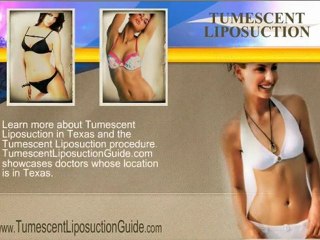 Tumescent Liposuction Texas