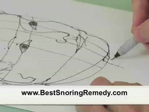 Snoring Cures