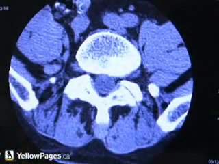 Chiropractor Vancouver, Back Pain Specialist