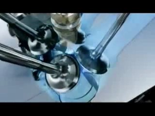 Renault Twingo RS : les secrets de son moteur