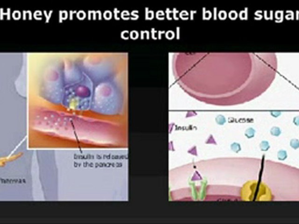 Difference between Honey and Sugar as Natural Sweeteners