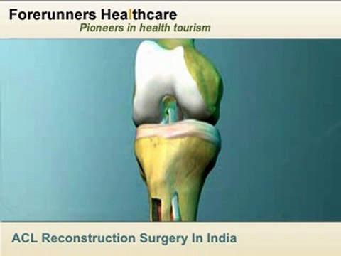 Get Anterior Cruciate Ligament Surgery in India