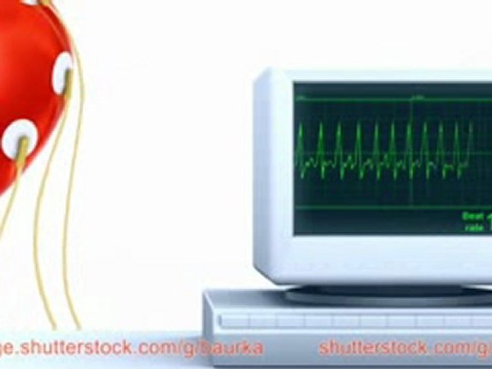 Heart examination