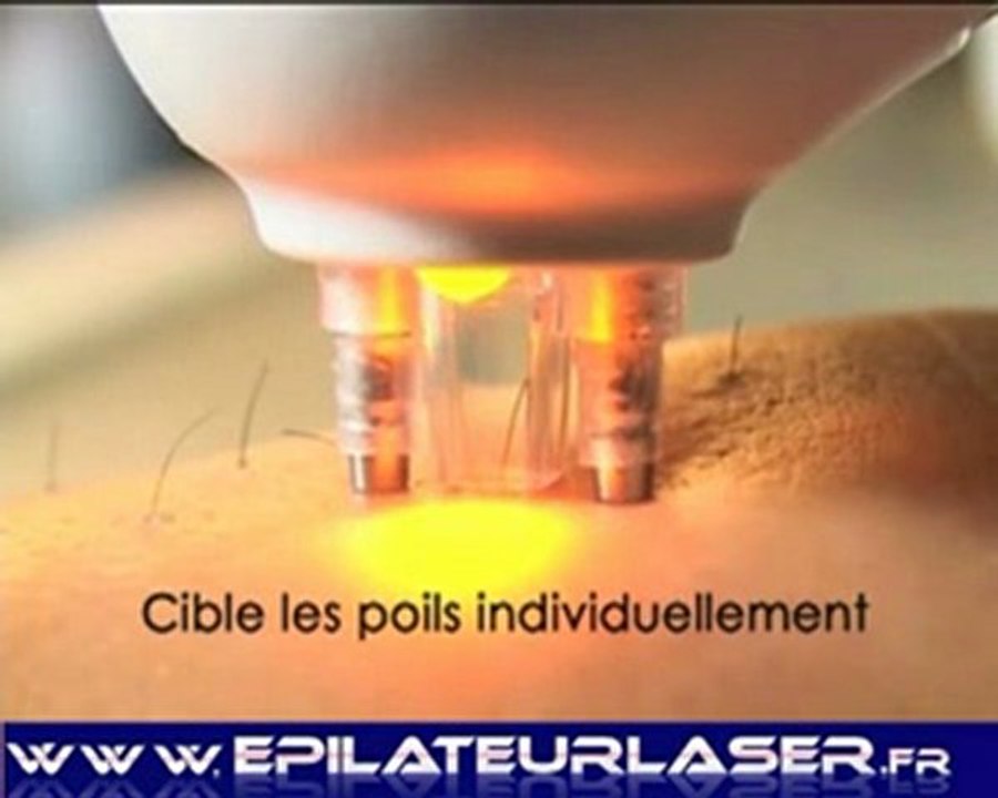 Epilation laser – rio laser