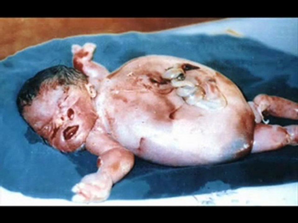 depleted uranium