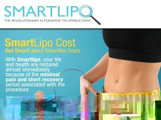 SMART LIPO COST