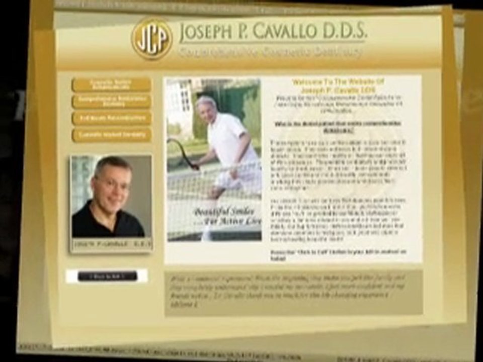 Porcelain Veneers Woodbridge VA - Joseph Cavallo DDS