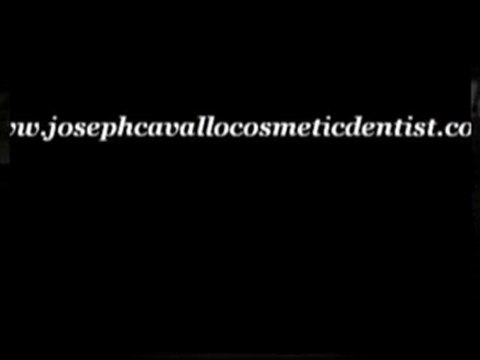 Porcelain Veneers Lorton VA-Joseph Cavallo Cosmetic Dentist