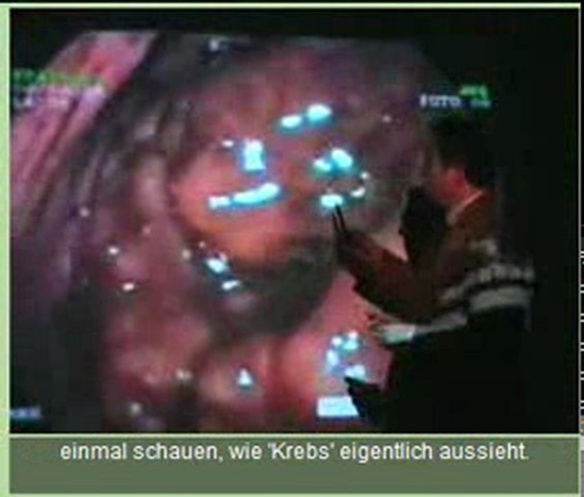 Infektionskrankheit KREBS, Teil 1