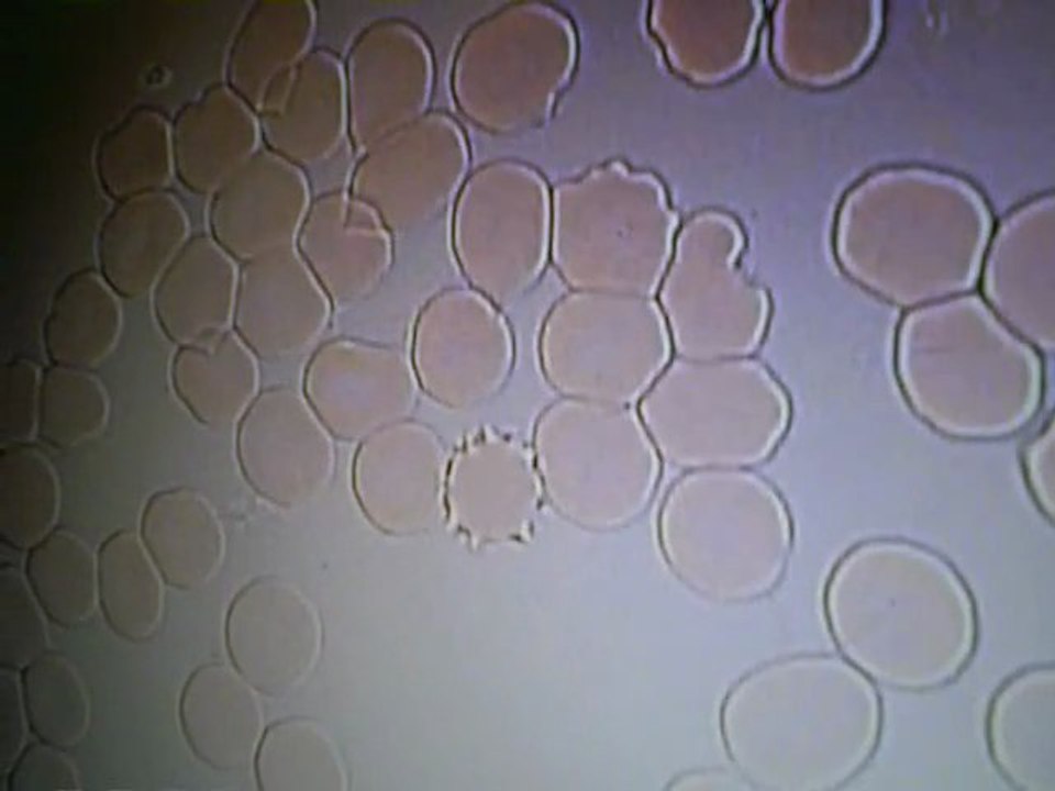 Live Blood Cell Analysis 011310