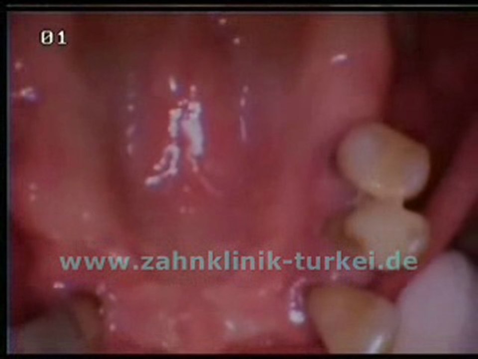 Anette Gotal (voher)