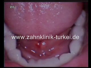 Anette Gotal (Keramik Brücke)