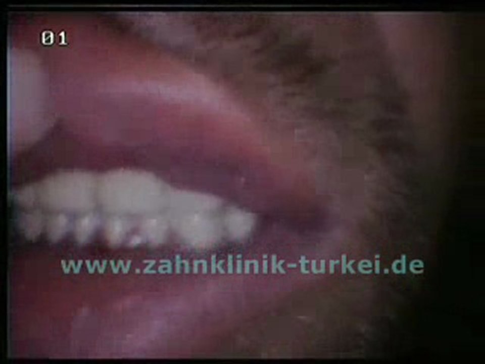 Frank Vorbau (Provisorische Brücke)