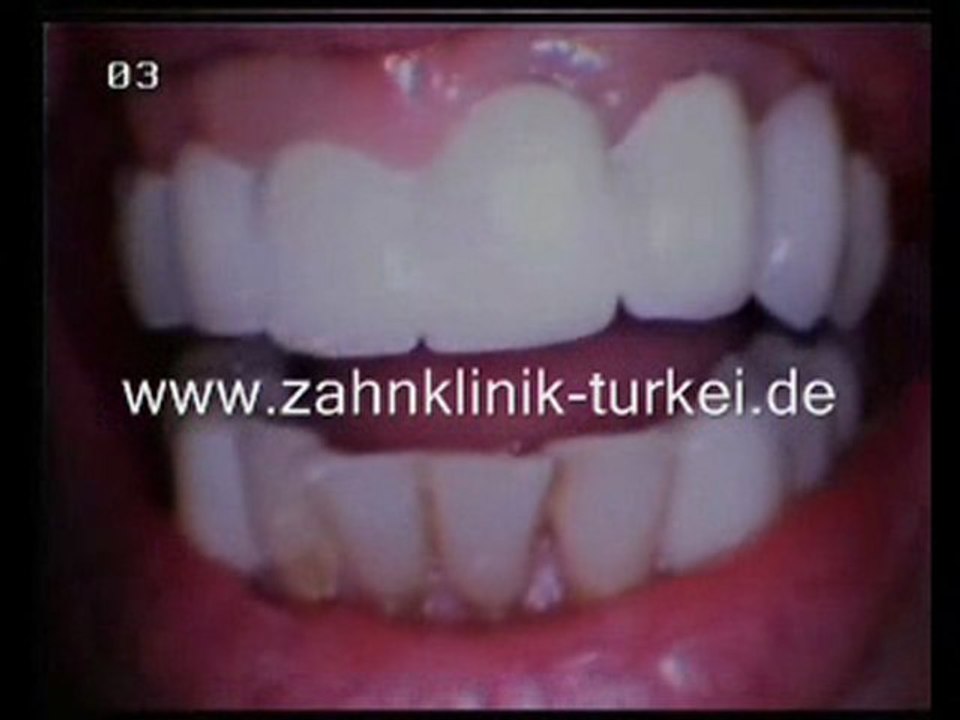 Frau Klohn (Befertigung)