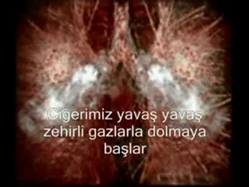 SİGARA AKCİĞERİ BİTİRİR