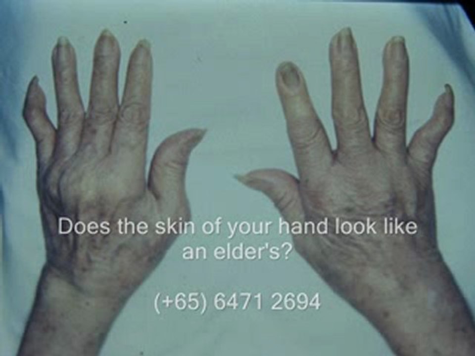Rheumatologic Conditions