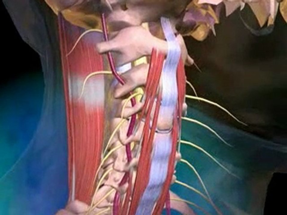 Do You Suffer from Neck Pain? - Atlanta Ga Gainesville Chiro