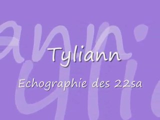 echo Tyliann 22 sa ^^ le 11 février 2010