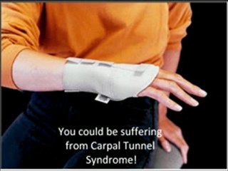 Carpal Tunnel Syndrome