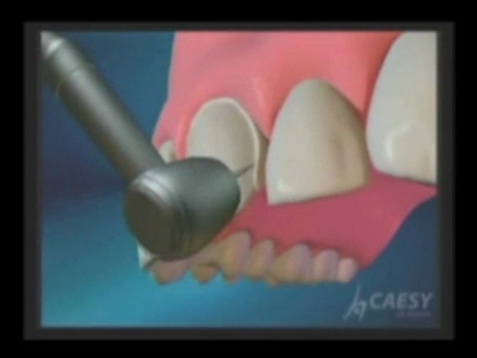 Dental need to floss our gums and teeth| Dr. Sahabi