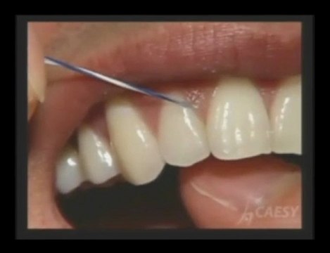Dental care by flossing gums and teeth|Dr. Sahabi