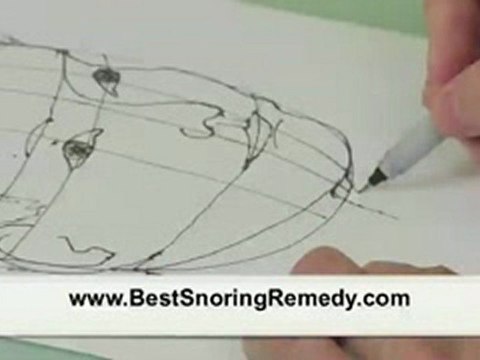 Snoring Cures Can Help