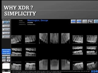 Dental Xray Sensor Sale