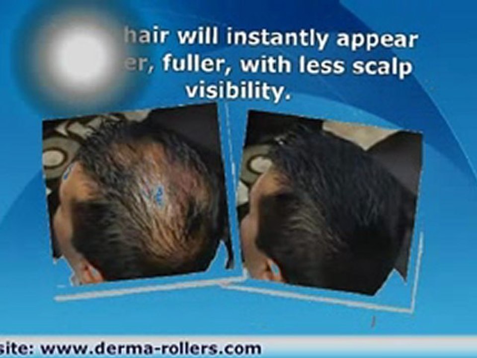 Spray On Hair Thickener