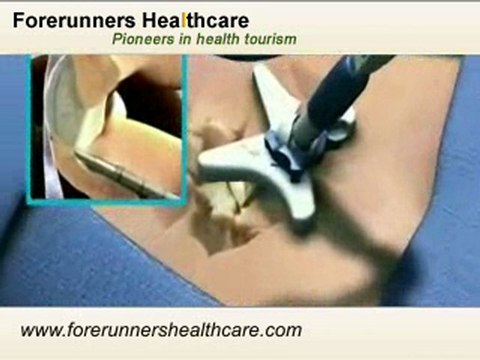 Get Minimally invasive Back Surgery in India at World Class