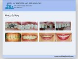 Cosmetic Dental Services by Gardena Dentist Dr. Joseph Azizi