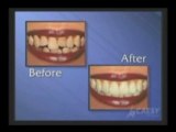 Dentist improves dental cosmetics