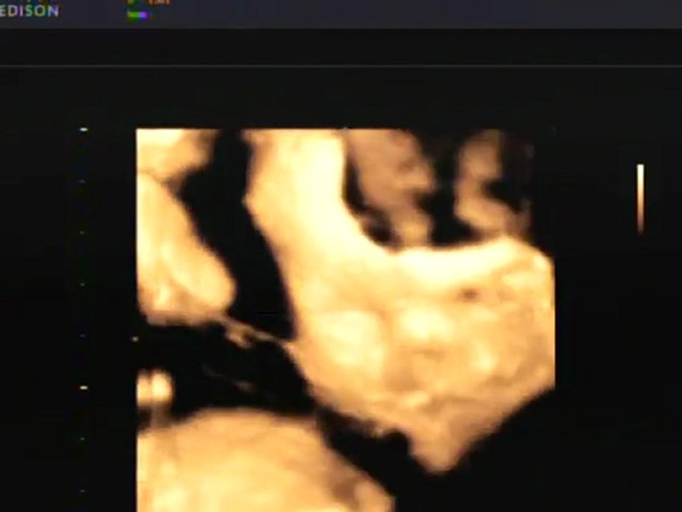 Echo 3D de Claire 18/02/2010