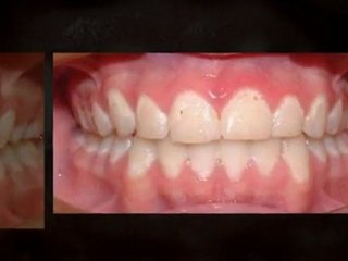 Greeley Orthodontist - Super Smiles By Doctor K