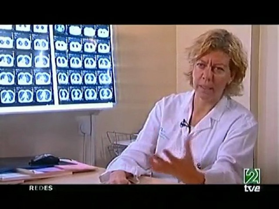 Cancer de pulmon