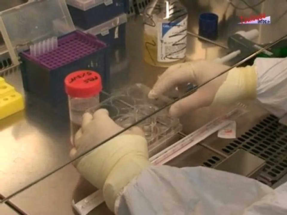 Découverte au sujet de l'infection par le cytomégalovirus