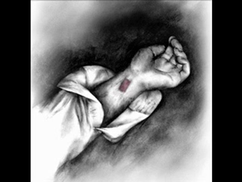 cengiz kurtoğlu yaralı , Damar , Uploadinq ßy Samedo54