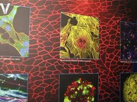 Maladies rares : quelles avancées grâce au Téléthon ?