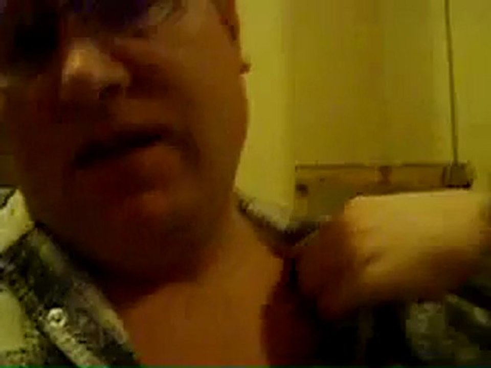 I show my scar on my left arm, and I try to show my broken
