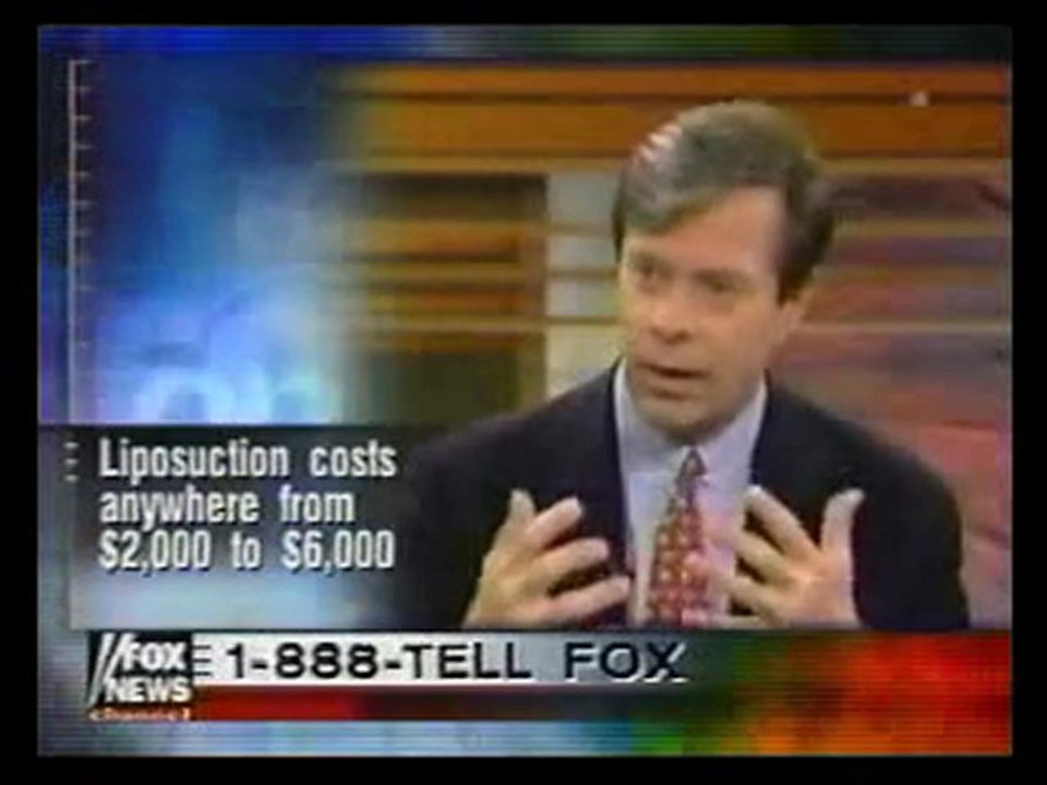 SMART LIPO MPX: SMART LIPO MPX SURGEONS