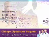 Chicago Liposuction Surgeons