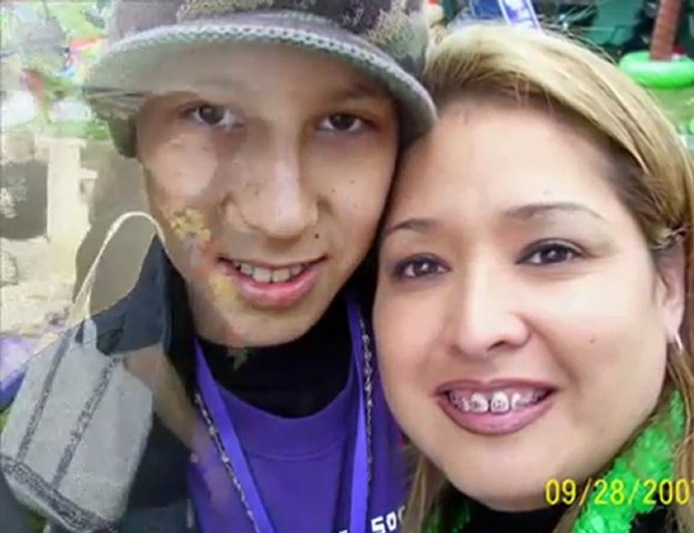 Camerons Brave Jouney(Childhood Cancer Ewing Sarcoma)