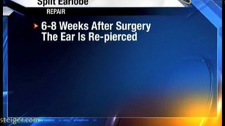Split Ear Repair in Florida