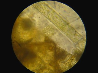 au microscope...