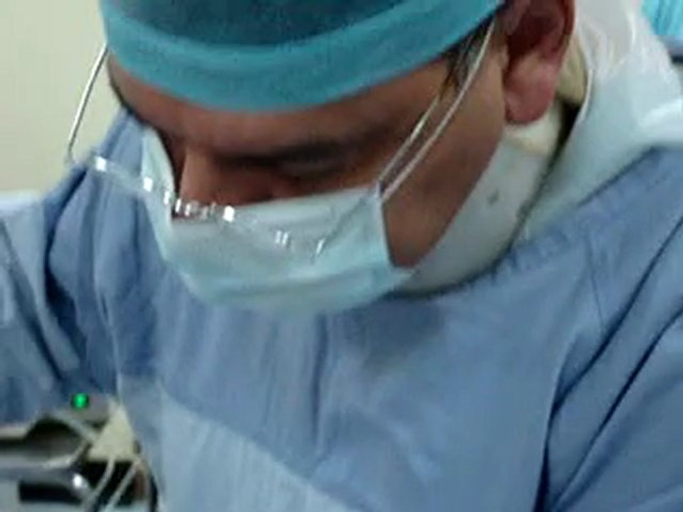 شفط الدهون-liposuction